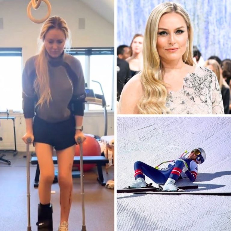 Lindsey Vonn shares a shocking health update after revealing her ankle is still broken five months after her Winter Olympics crash