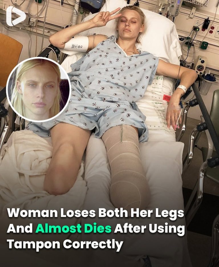 Woman Lost Both Her Legs And Almost Died After Using Tampon Correctly