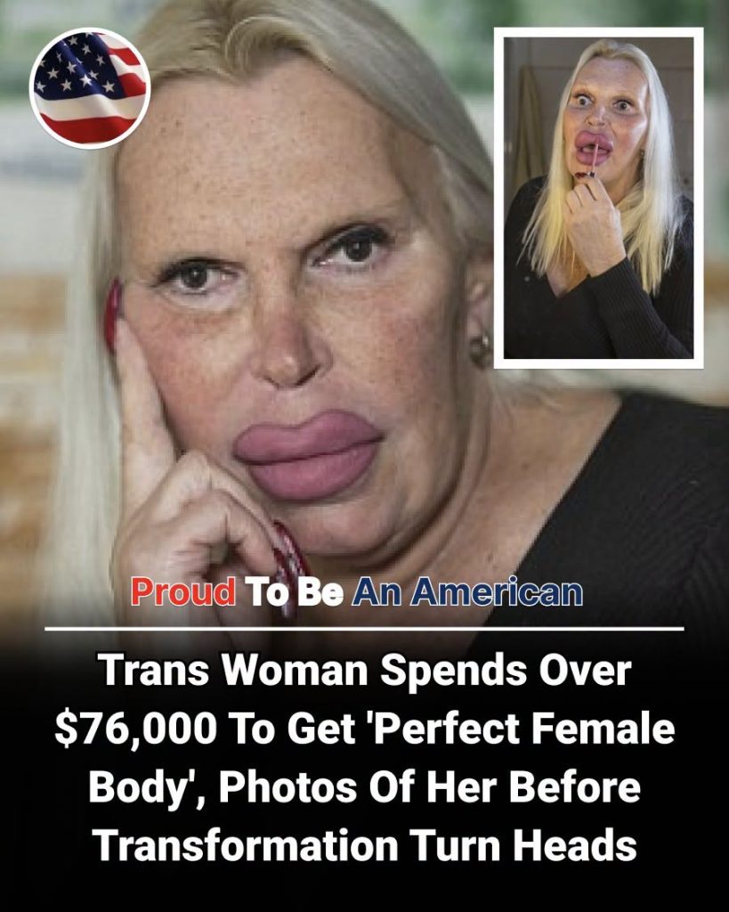 Trans Woman Spends $76K To Get 'The Perfect Female Body', Here's What She Looked Like Before