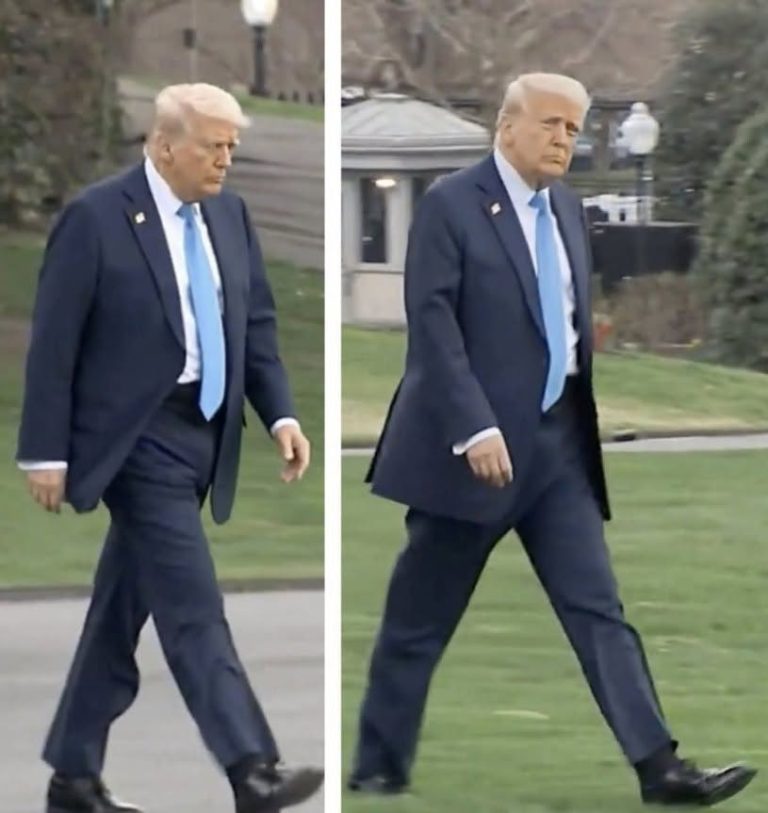 Trump’s Changing Appearance Fuels Fresh Debate Over His Health and Fitness