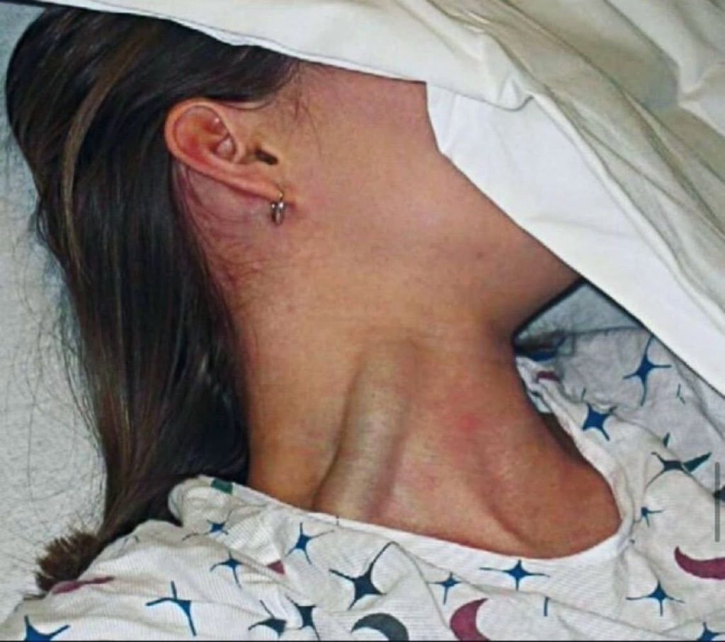 These Are the Consequences of Sleeping With the Fan On