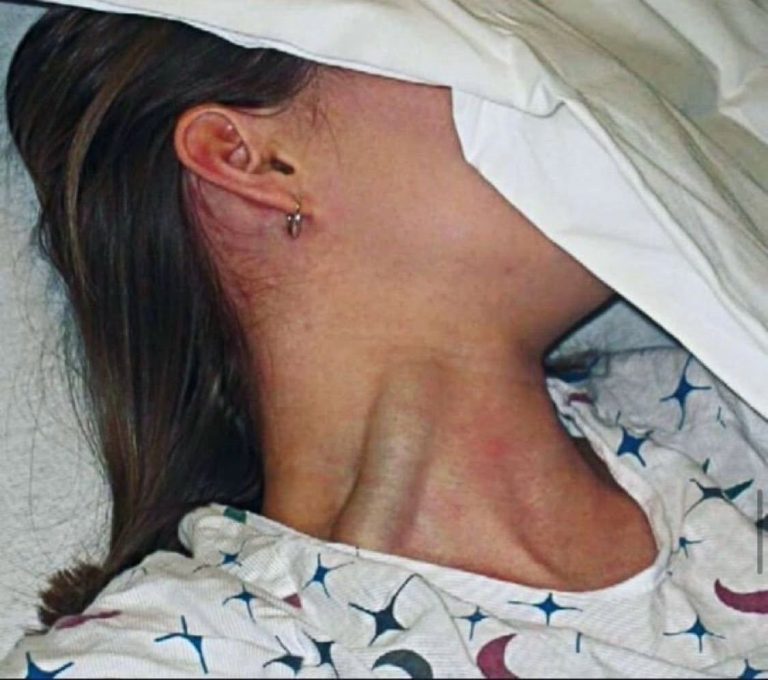 These Are the Consequences of Sleeping With the Fan On