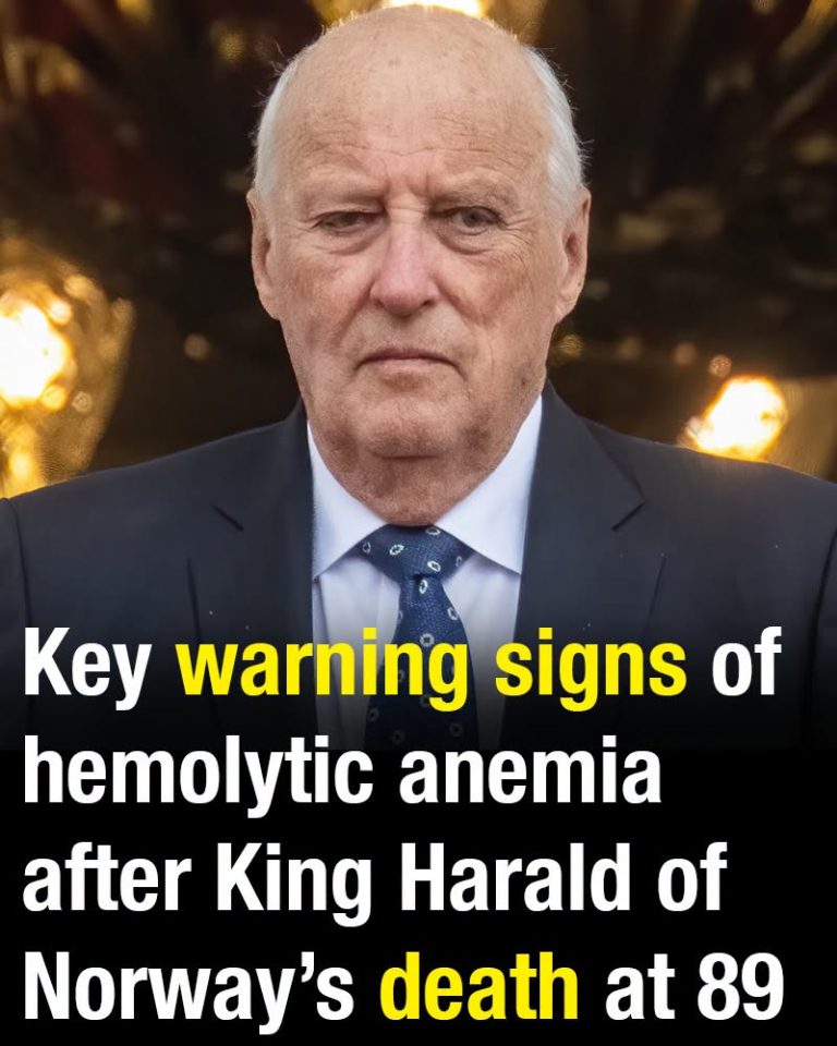 Key warning signs of hemolytic anemia after King Harald of Norway’s death at 89