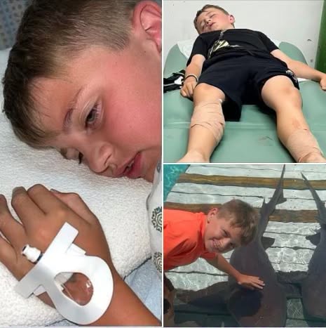 Young boy attacked by three sharks in Bahamas after tourists threw food in water