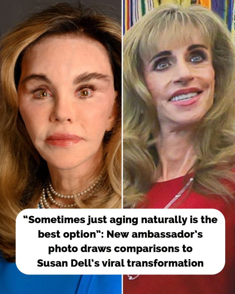 New ambassador’s portrait draws brutal comparisons to Susan Dell as people spot troubling pattern: “MAGA Face”